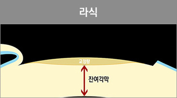 라식이미지