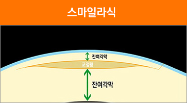 라식이미지