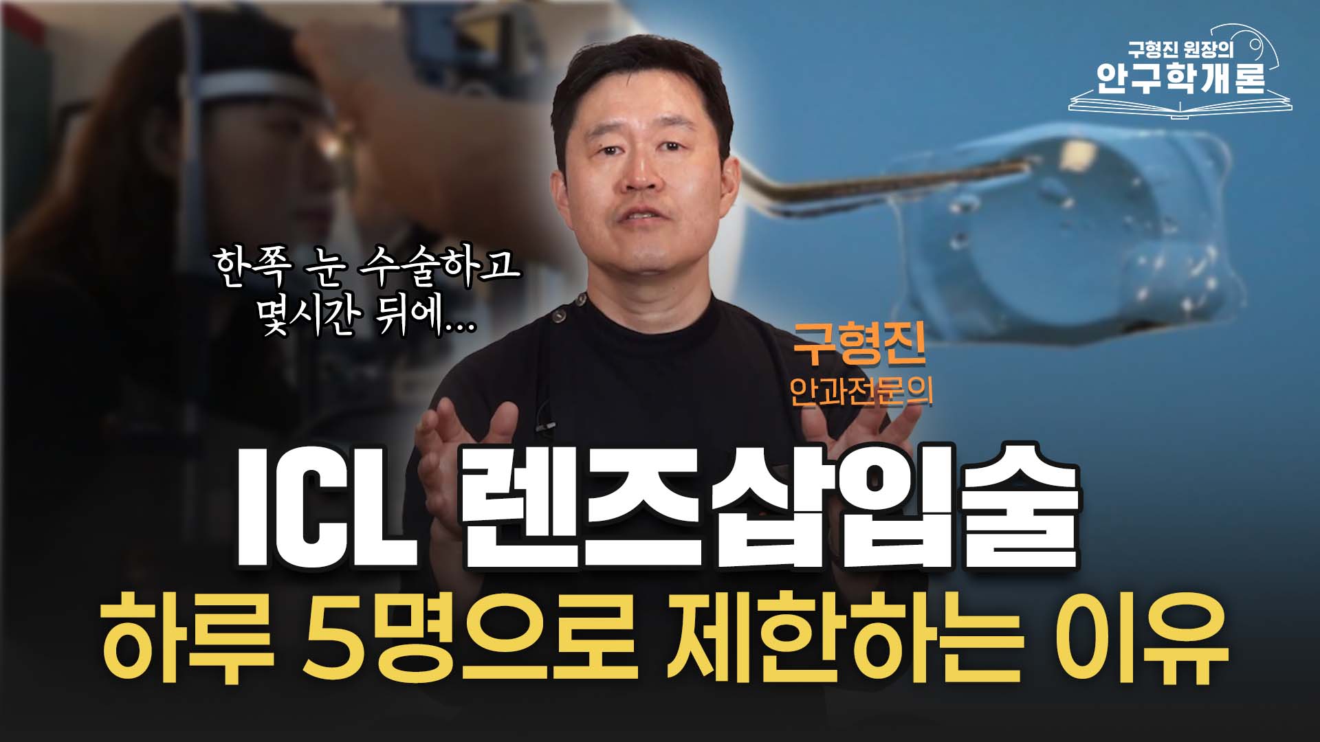 [안구학개론] ICL 렌즈삽입술 받기 전에 한 번쯤 생각해 볼 이야기
