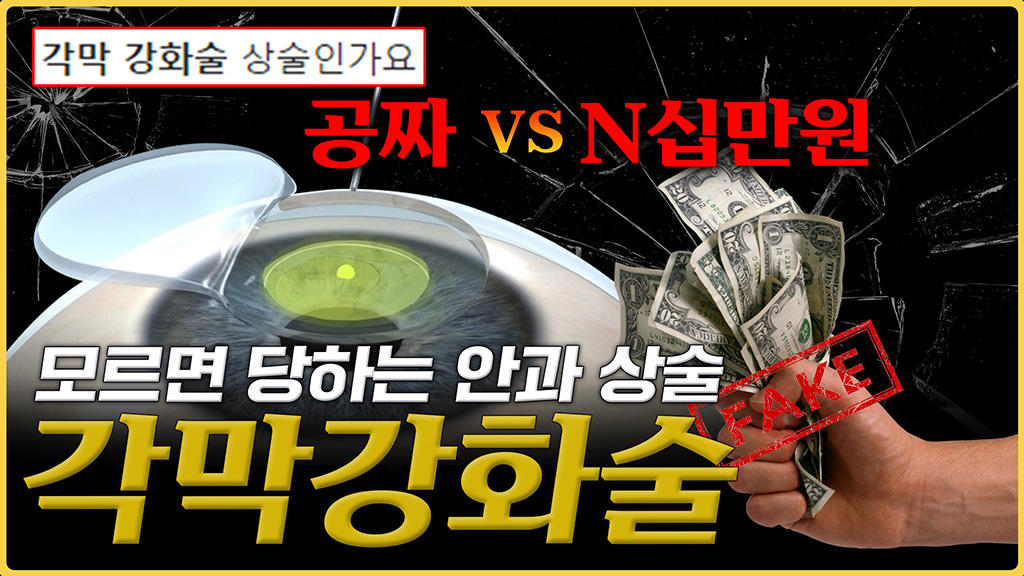 각막강화술, 많은 분들이 놓치는 핵심 포인트 [2분요약]