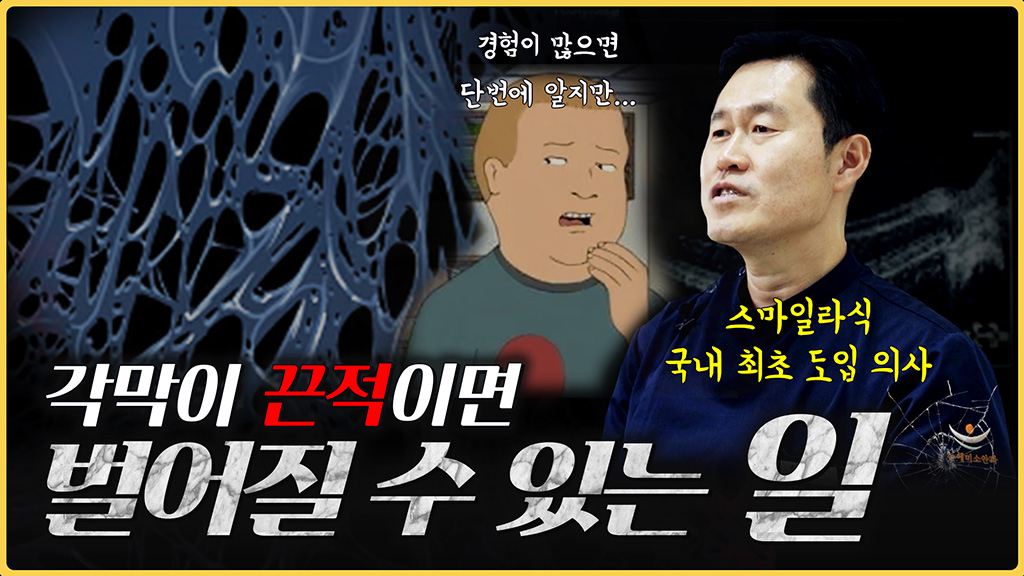 스마일라식 도입 의사가 말하는 스마일라식, 의사 '손기술'이 중요한 진짜 이유
